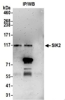 Rabbit anti-SIK2 Antibody