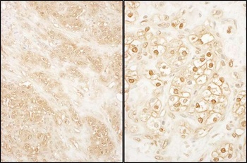 Rabbit anti-PCTAIRE 2 Antibody
