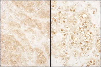 PCTAIRE 2 Antibody