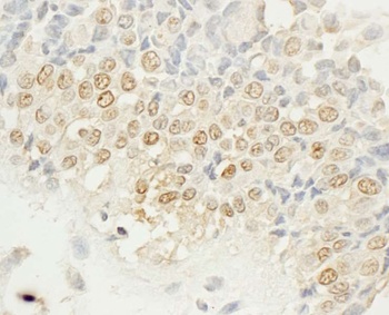 Rabbit anti-NEK4 Antibody