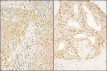 Rabbit anti-CaMKK alpha Antibody