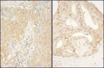 CaMKK alpha Antibody