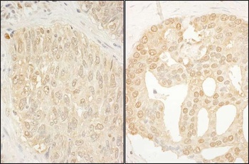 Rabbit anti-CaMKK alpha Antibody