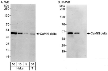 Rabbit CaMKI delta Antibody