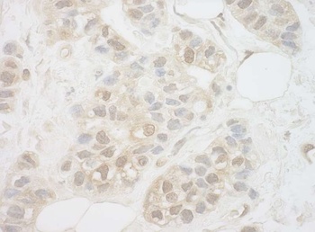 Rabbit anti-UCKL1 Antibody