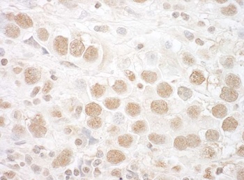 Rabbit anti-CTNNBL1 Antibody