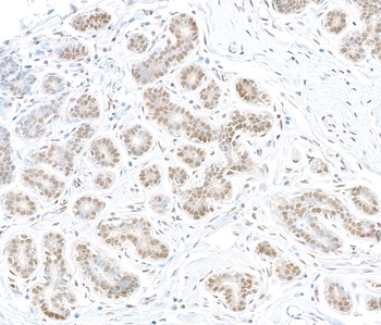 MTMR15 Antibody