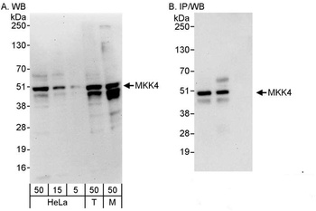 Rabbit MKK4 Antibody