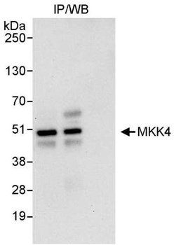 Rabbit MKK4 Antibody