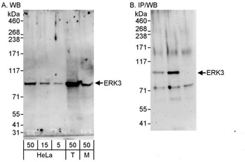 Rabbit ERK3 Antibody