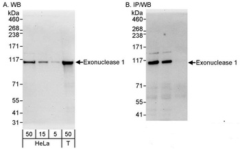 Rabbit Exonuclease 1 Antibody