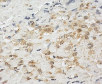 Rabbit anti-LPP Antibody