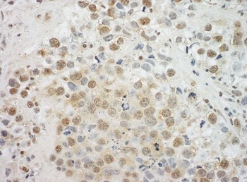 Rabbit anti-EYA4 Antibody