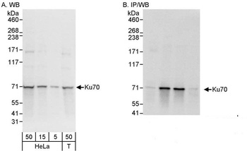Rabbit Ku70 Antibody