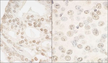 Rabbit FOXP1 Antibody