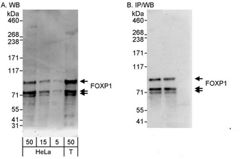 Rabbit FOXP1 Antibody