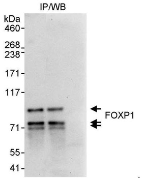 Rabbit FOXP1 Antibody