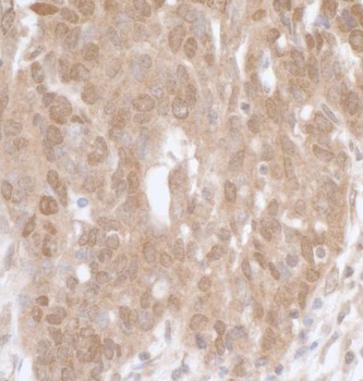 Rabbit MK5 Antibody