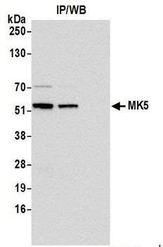 Rabbit MK5 Antibody