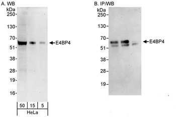 Rabbit E4BP4 Antibody
