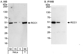 Rabbit RCC1 Antibody