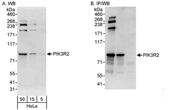 Rabbit PIK3R2 Antibody