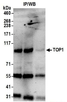 TOP1 Antibody