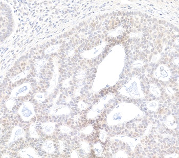 Rabbit anti-BRD2 Antibody