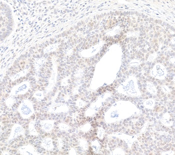 BRD2 Antibody