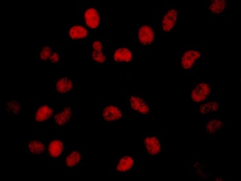Rabbit anti-BRD2 Antibody