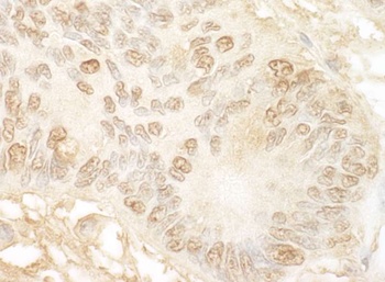 Rabbit anti-JMY Antibody