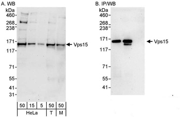 Rabbit Vps15 Antibody