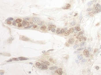 Rabbit anti-ARID3B Antibody
