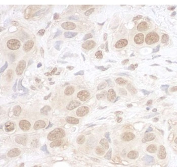 Rabbit anti-ARID3B Antibody