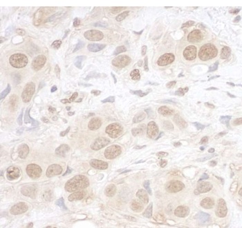 ARID3B Antibody