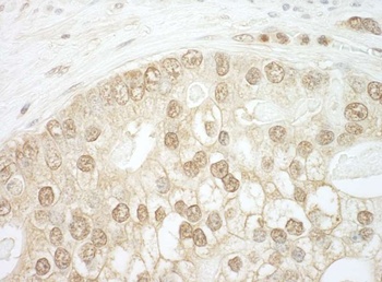 Rabbit anti-CNOT2 Antibody