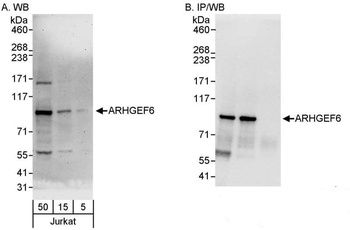 Rabbit anti-ARHGEF6 Antibody