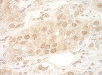 Rabbit anti-eIF2B5 Antibody