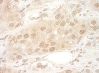 eIF2B5 Antibody