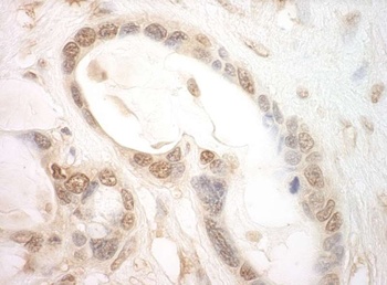 Rabbit anti-eIF2B5 Antibody