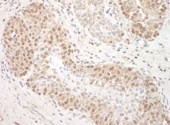 TFIP11 Antibody