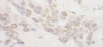 Rabbit anti-IBP160 Antibody