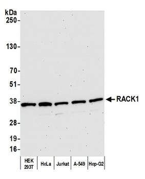 Rabbit anti-RACK1 Antibody