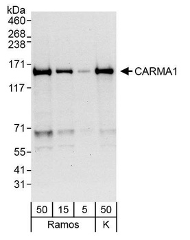Rabbit CARMA1 Antibody