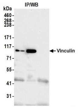 Vinculin Antibody