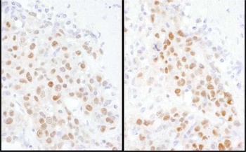 Rabbit MBD3 Antibody