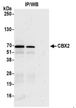 Rabbit CBX2 Antibody