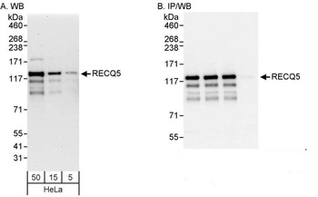 Rabbit RECQ5 Antibody