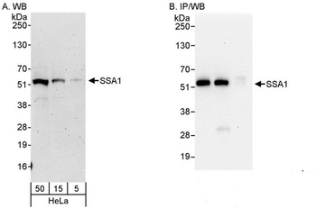 Rabbit SSA1 Antibody