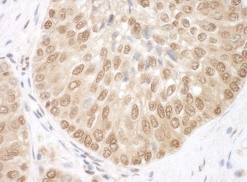 Rabbit BRCC36 Antibody